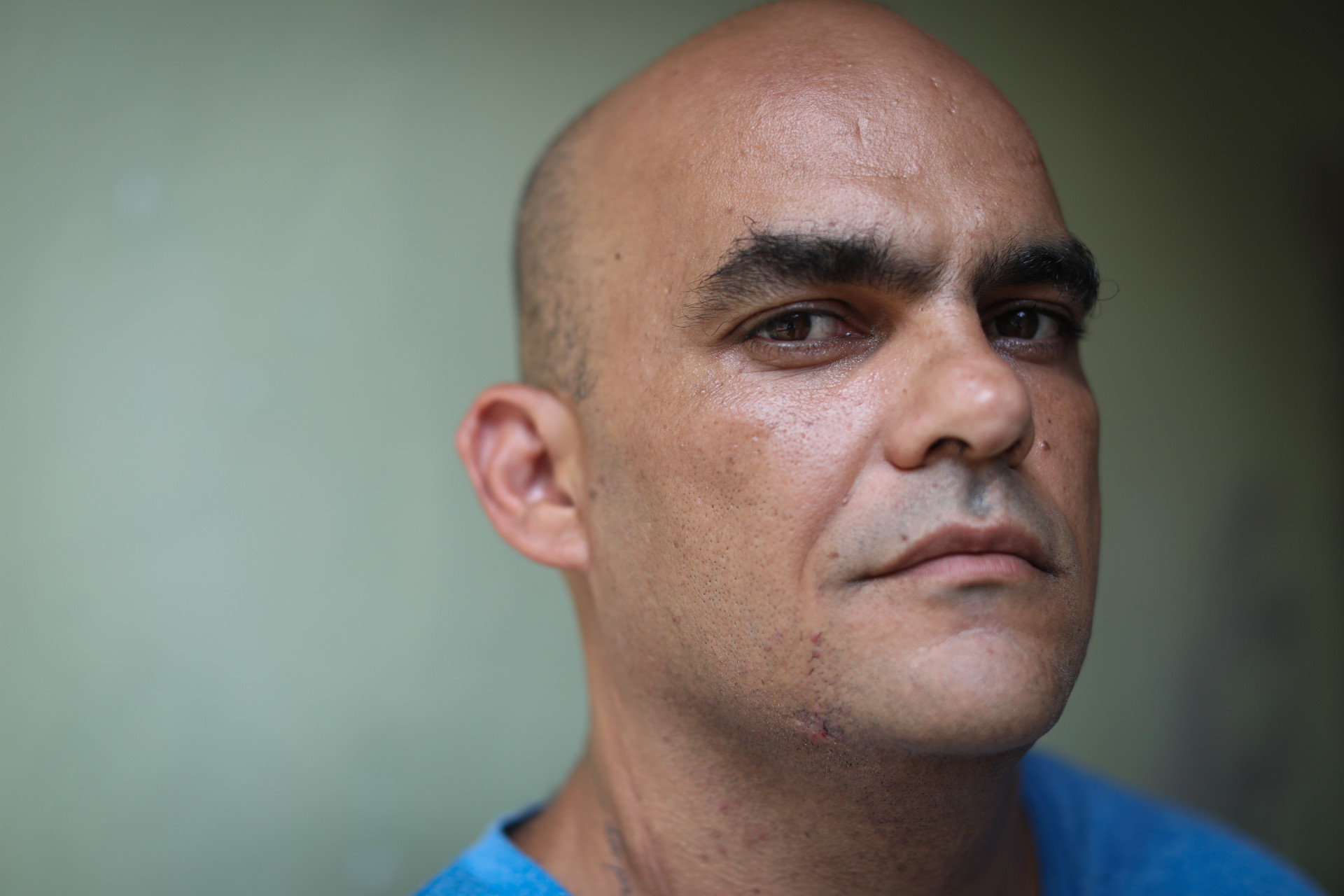 Jairo Say&atilde;o chegou a desenvolver depress&atilde;o ap&oacute;s retomar do coma e perceber que n&atilde;o poder&aacute; mais ter a vida que tinha antes. Ele foi reformado e hoje estuda f&iacute;sica na faculdade - Pedro Ivo/ Ag&ecirc;ncia O Dia