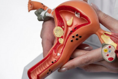 Veja as novas regras para realizar a laqueadura e a vasectomia