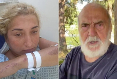 Mulher é atropelada por Lima Duarte e quebra cinco ossos