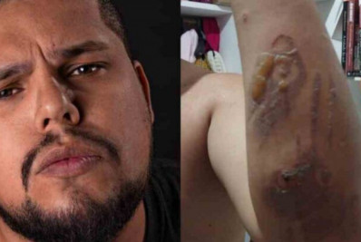 Entregador antifascista 'Galo' denuncia tortura cometida por policiais