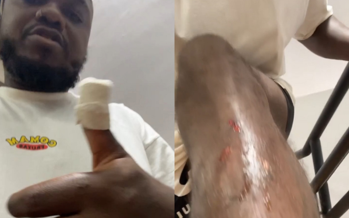 Djonga mostra ferimentos leves após sofrer acidente de moto - Reprodução/Instagram