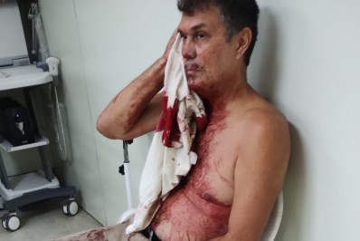 Guarda municipal é ferido na cabeça após viatura ser apedrejada em Copacabana