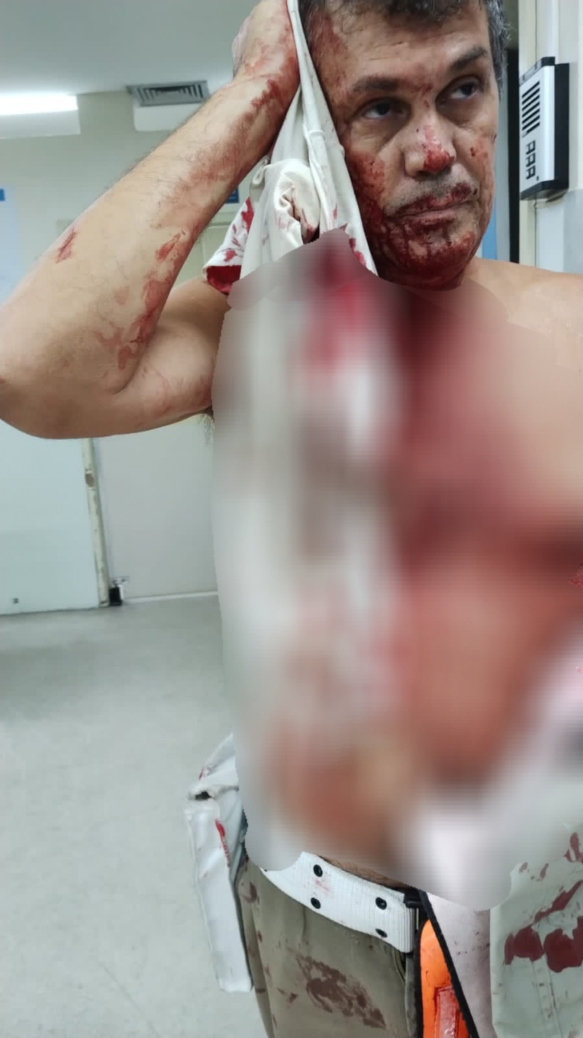 Ferido na cabe&ccedil;a, guarda foi socorrido ao Hospital Miguel Couto - Reprodu&ccedil;&atilde;o