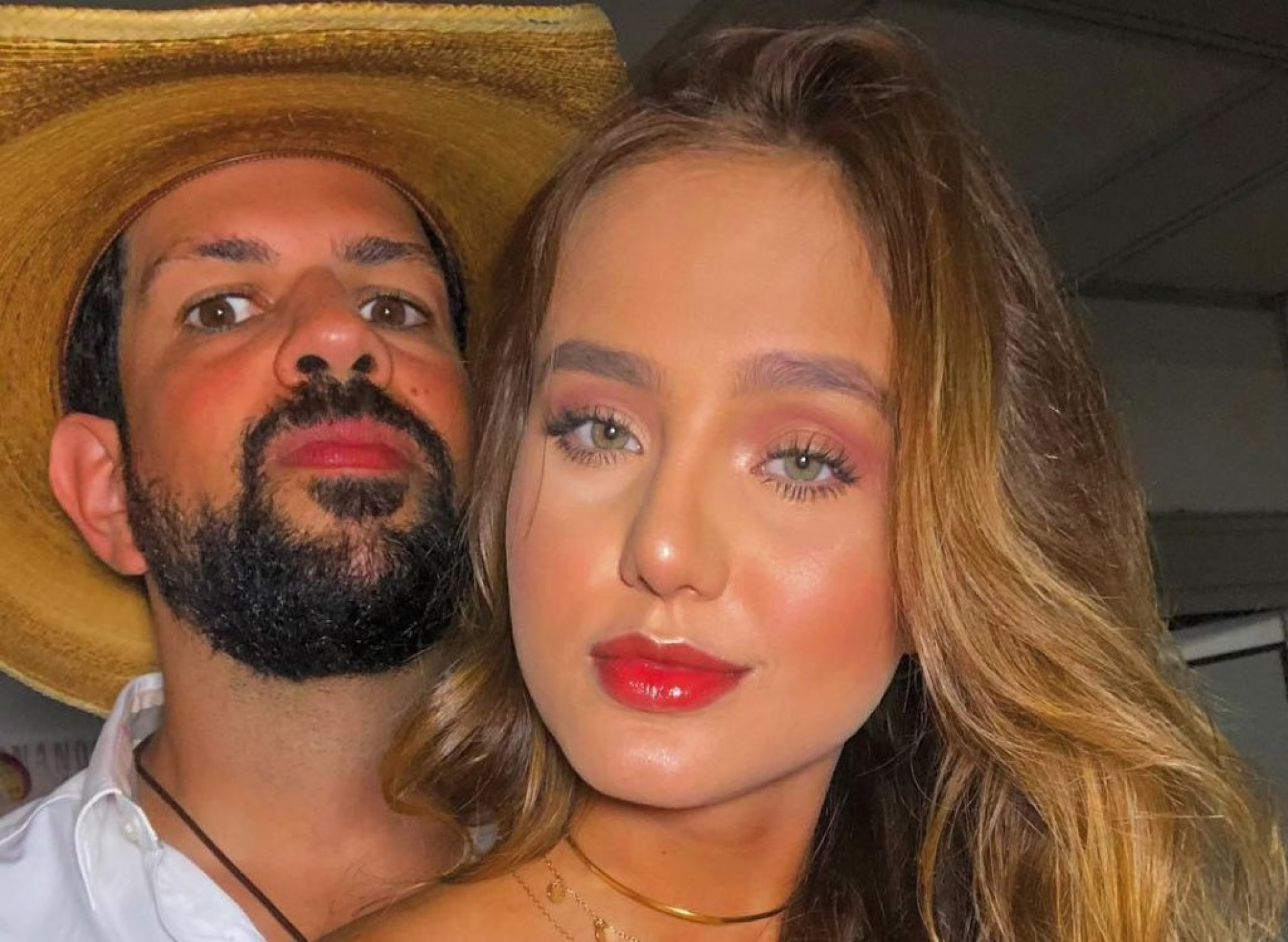 Mulher de Sorocaba contraiu uma sarna na perna  - Reprodução/Instagram