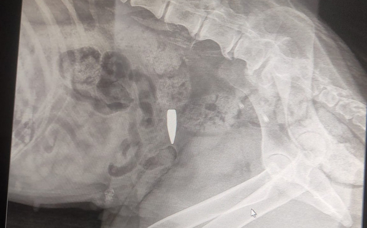 Radiografia mostra bala alojada nas costas: passou perto da coluna