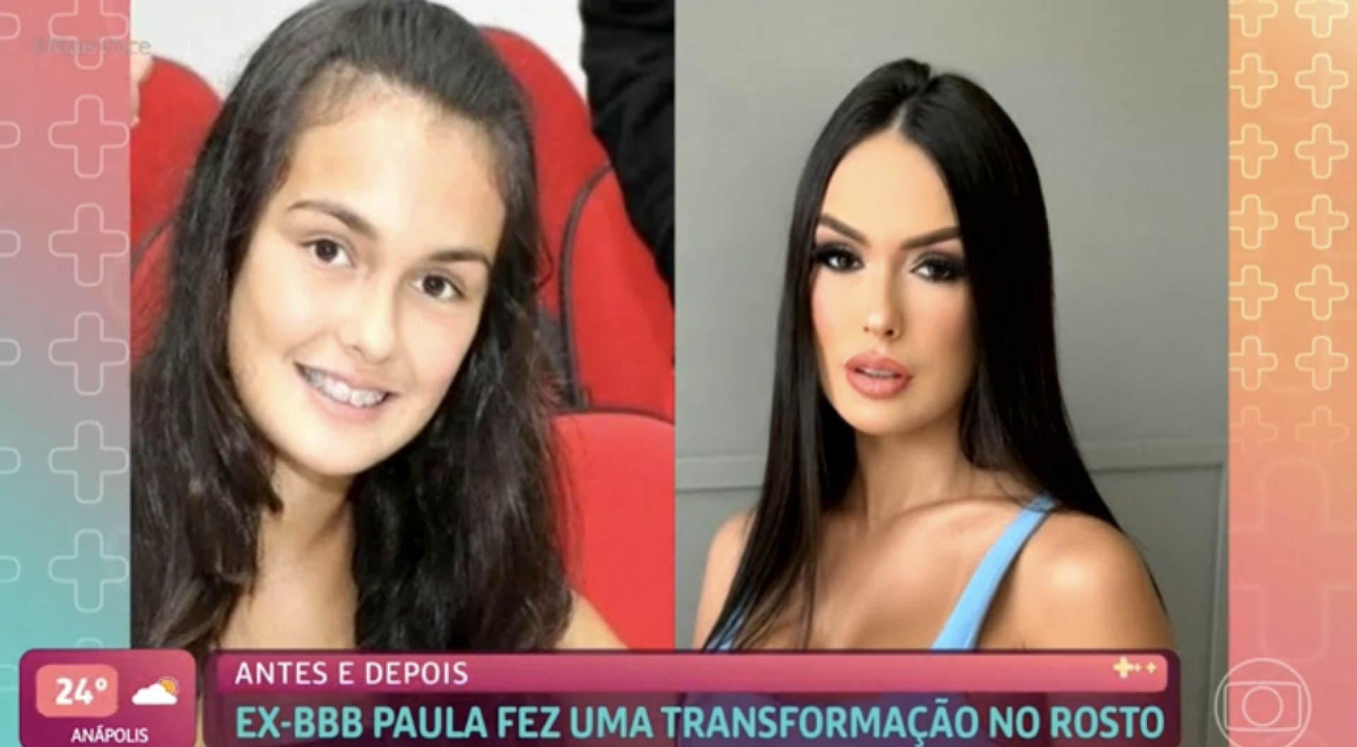 Ana Maria Mostra Antes E Depois De Larissa No Mais Você Eu Tinha 13 Anos Bbb O Dia 8663