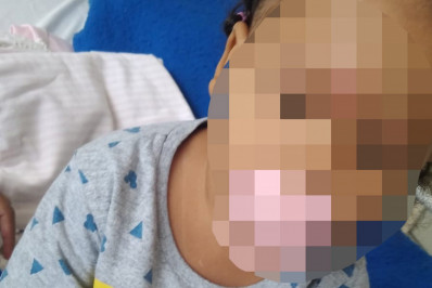 Família diz que bebê teve dedo amputado por erro médico: 'Queriam esconder'