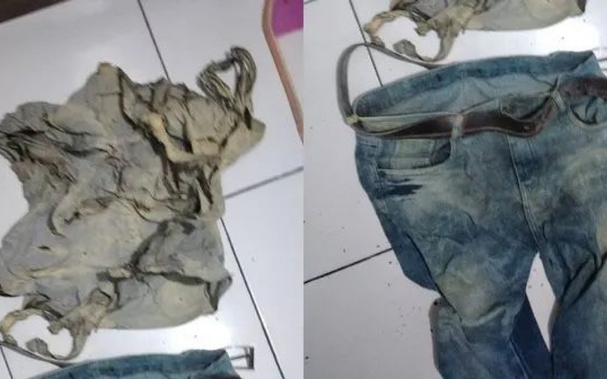 Camiseta da v&iacute;tima ficou totalmente queimada