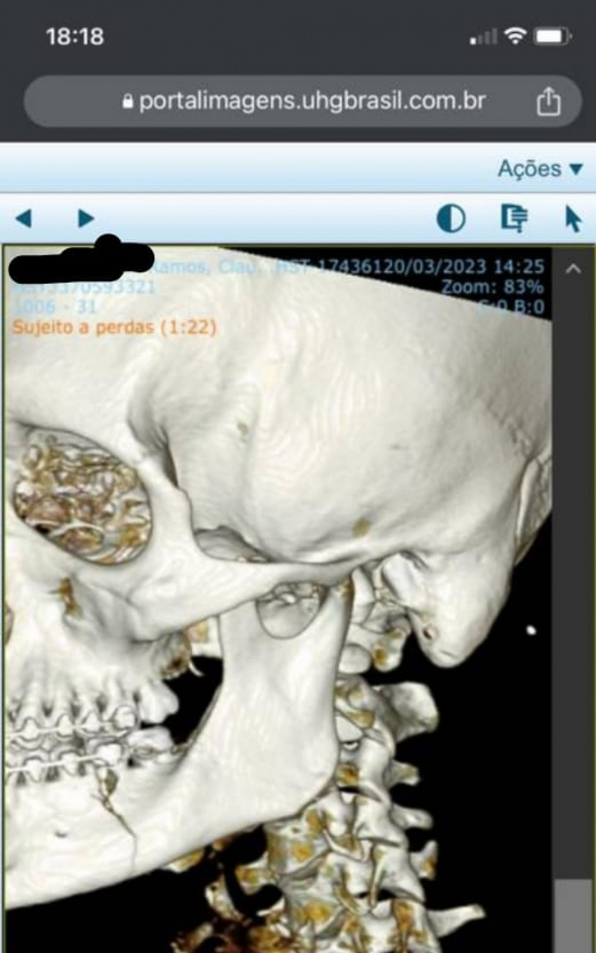 Tomografia de Cl&aacute;udio Ramos confirma fratura no maxilar ap&oacute;s agress&otilde;es