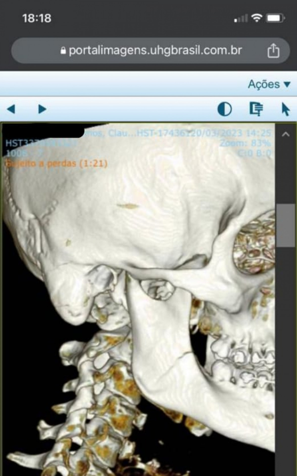 Tomografia de Cl&aacute;udio Ramos confirma fratura no maxilar ap&oacute;s agress&otilde;es