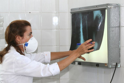 Brasil registra 78 mil novos casos de tuberculose