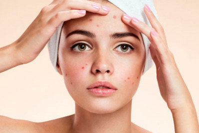 Acne de outono: dermatologista dá dicas de como evitar