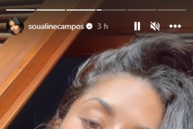 Aline Campos mostra arranhões na barriga após acidente com cães