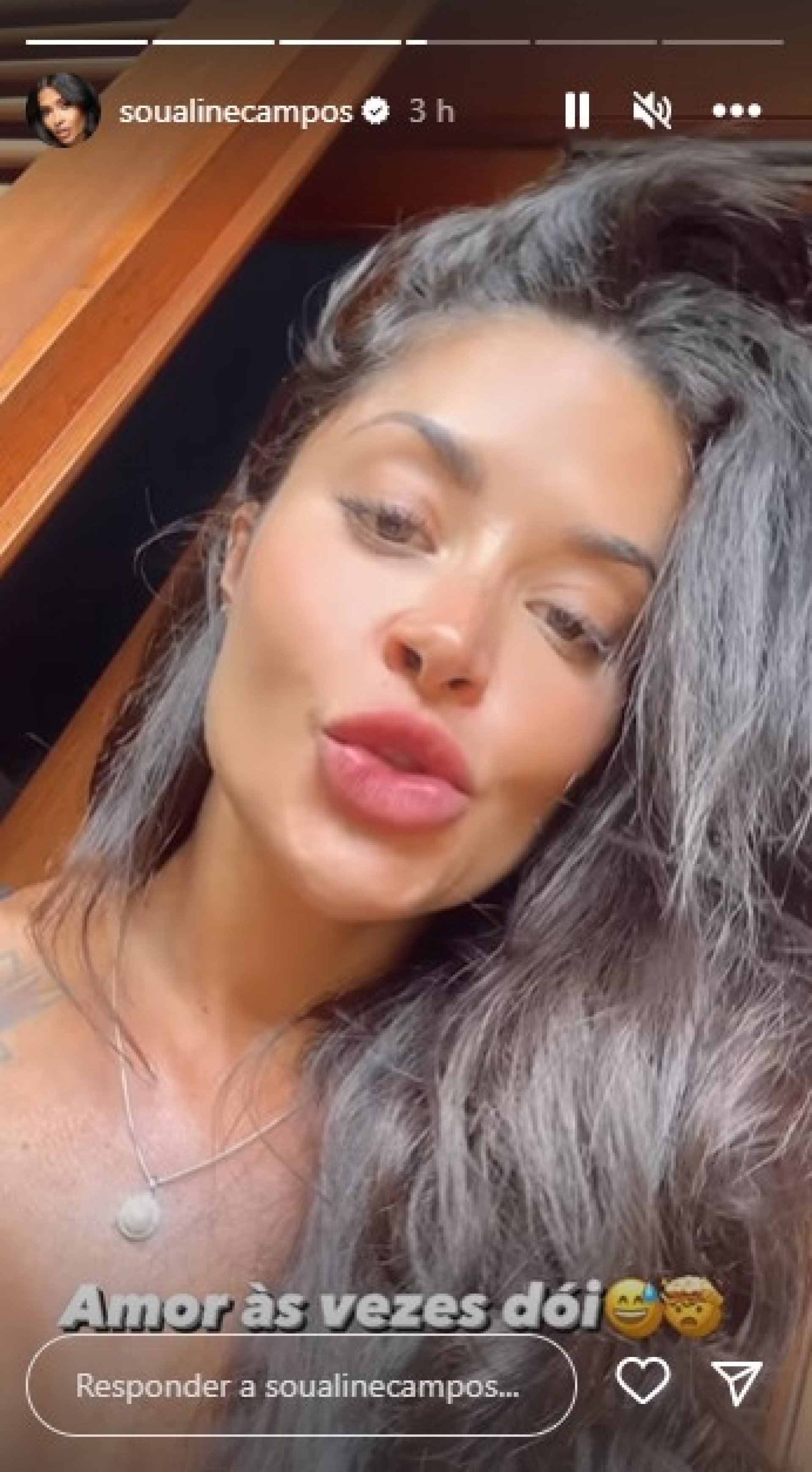 Atriz mostrou acidente com pet's enquanto gravava vídeo para as redes sociais - Reprodução/Instagram