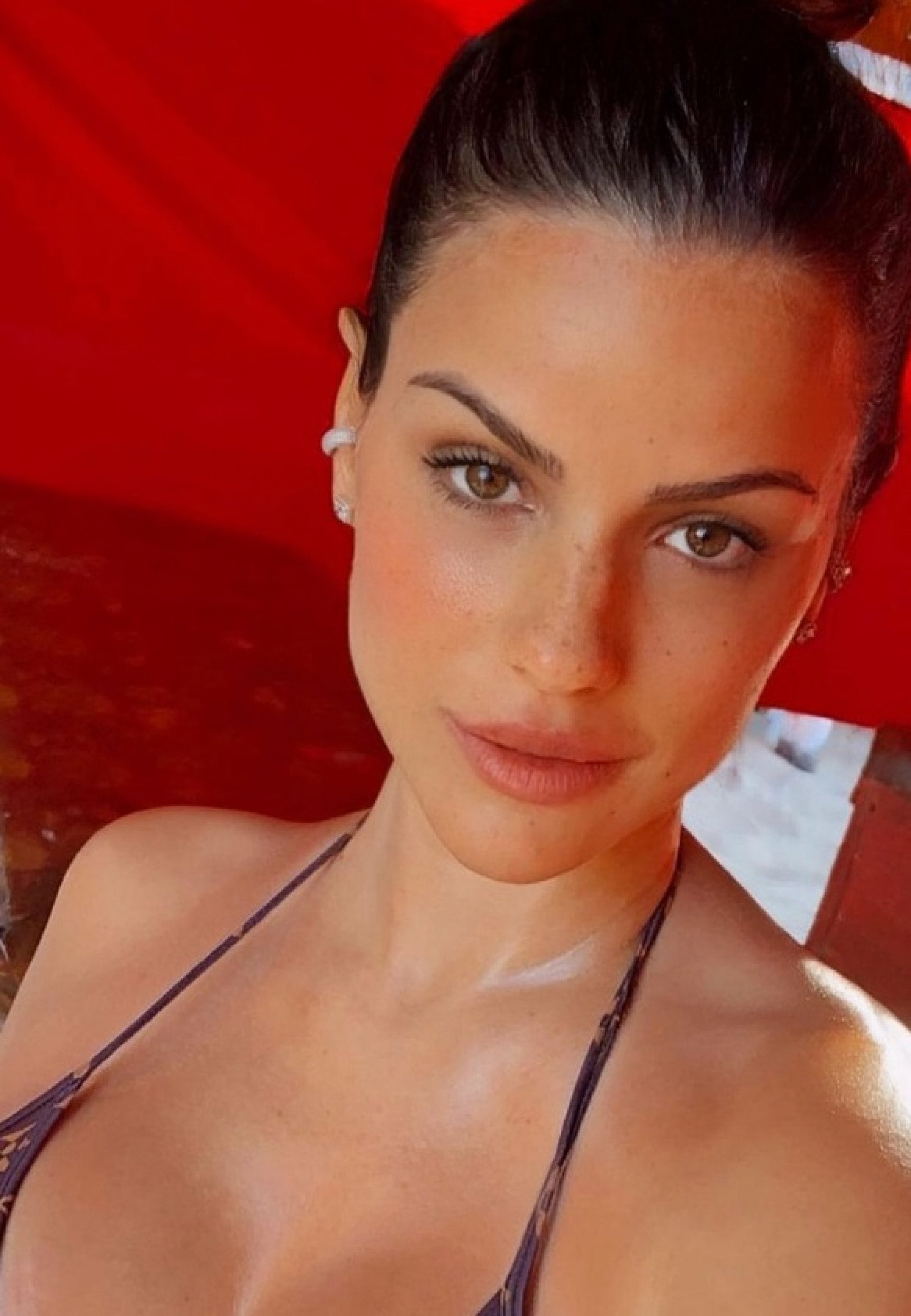 Carol Dias é operada após ser diagnosticada com apendicite - Reprodução do Instagram