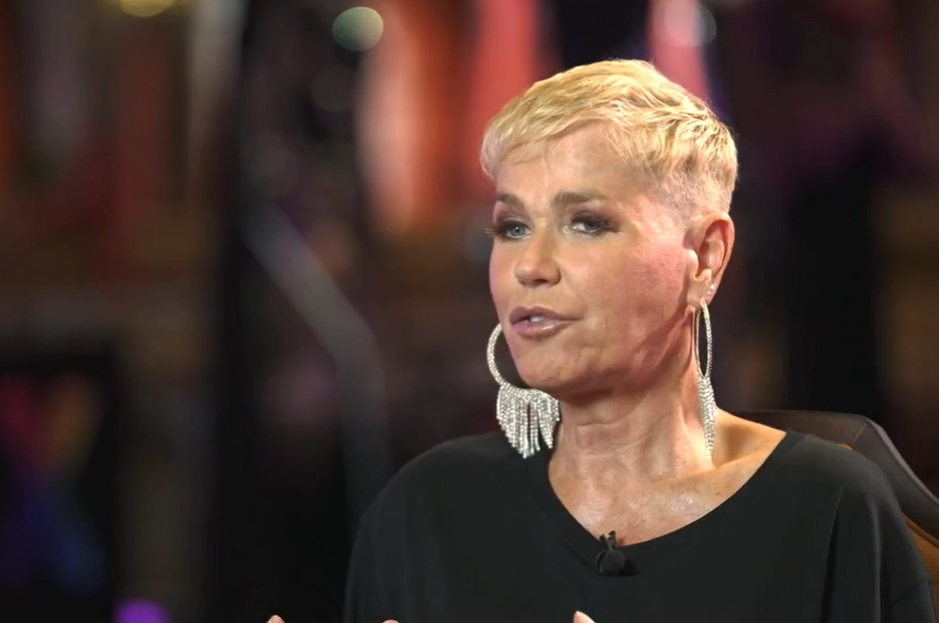 Xuxa abre o jogo sobre paralisia que sofreu com cirurgia plástica