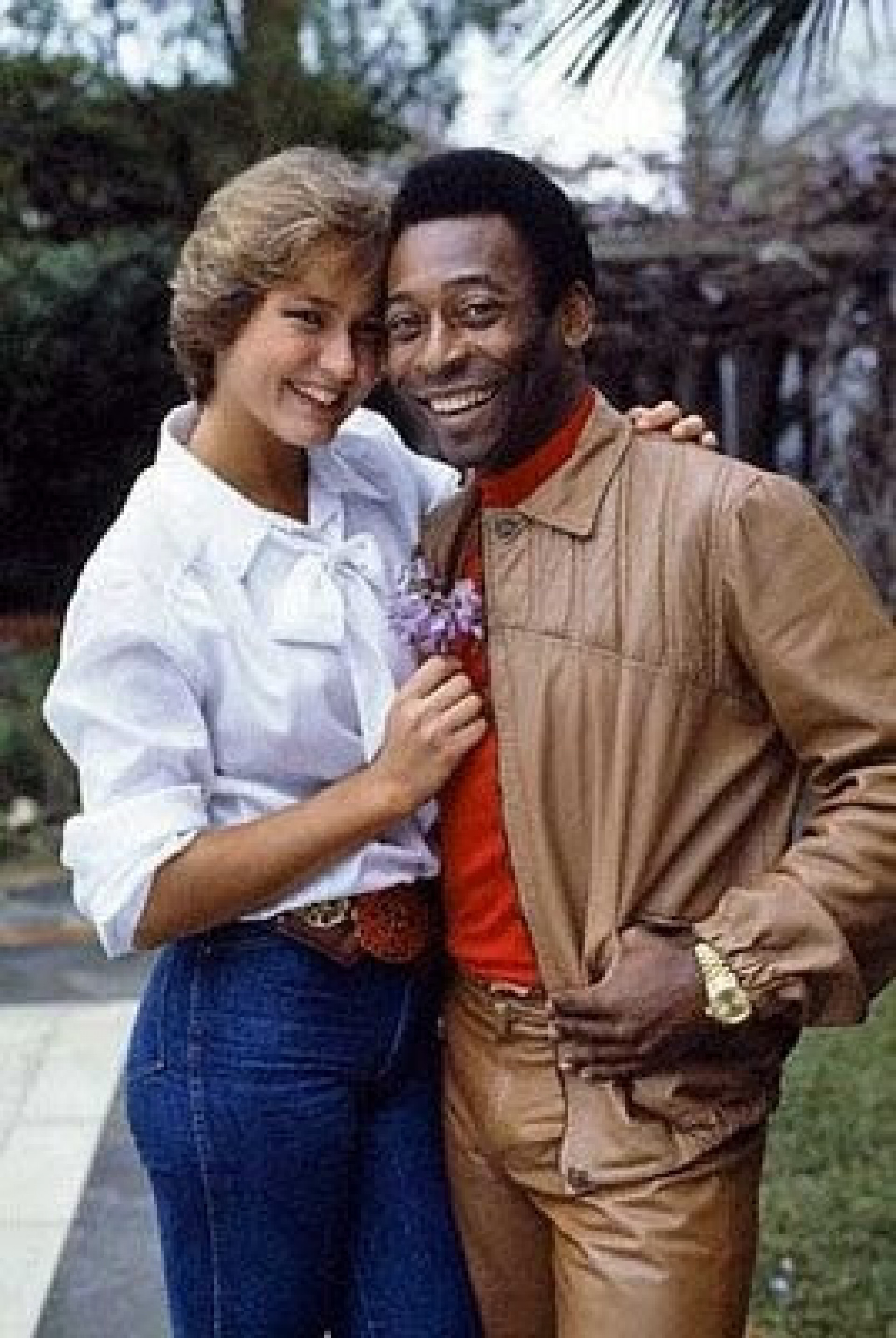 Cirurgião fez correção no nariz de Xuxa no período em que ela namorava Pelé - Reprodução/Internet