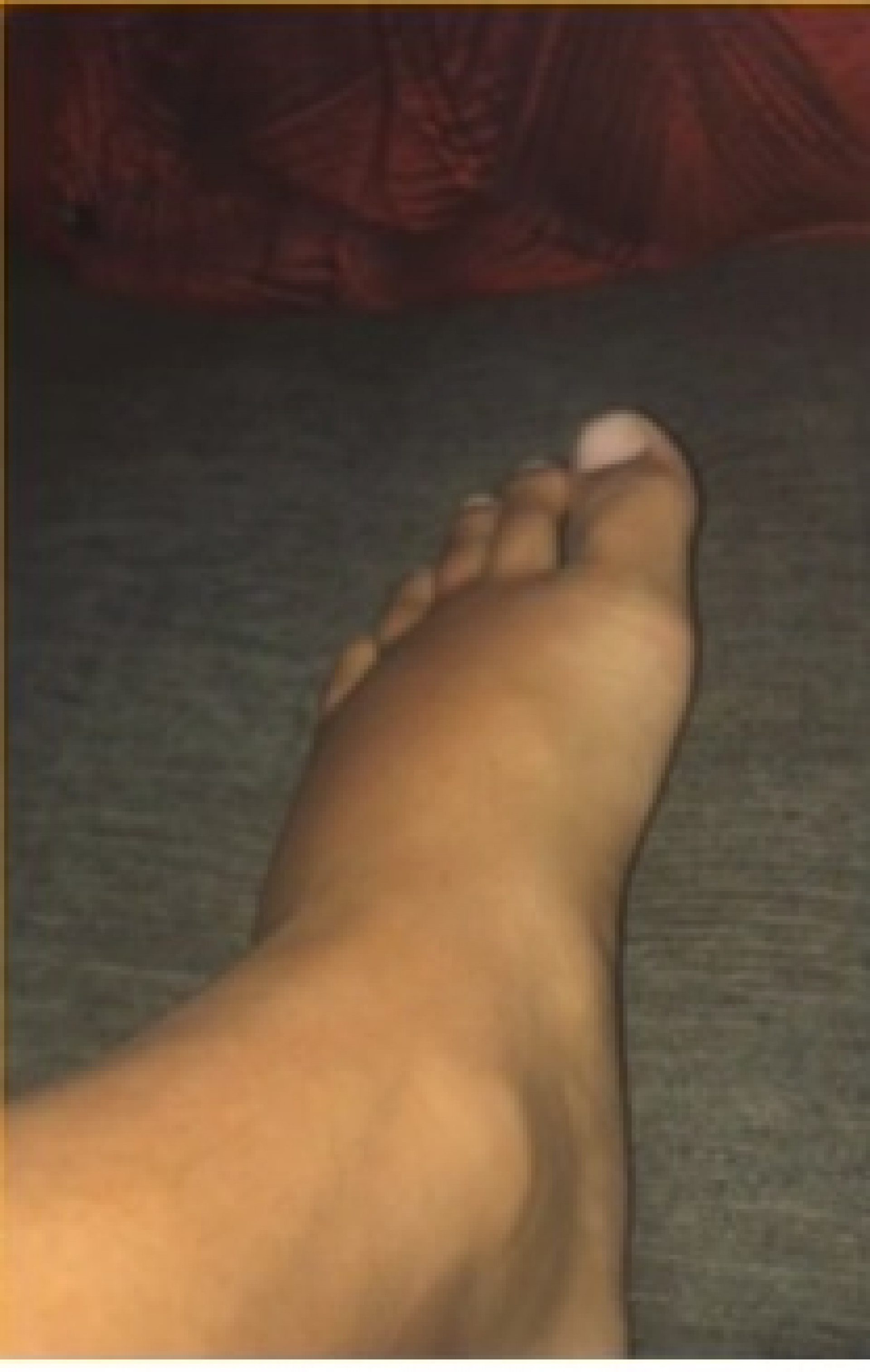 Gabriel Ara&uacute;jo de Oliveira percorreu unidades m&eacute;dicas ap&oacute;s machucar o p&eacute;