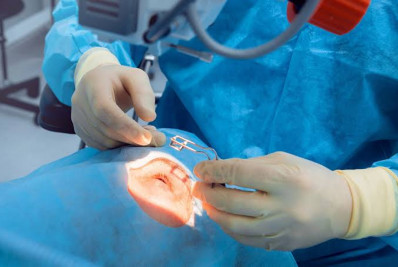 Saúde pública municipal registra mais de três mil cirurgias de catarata em cerca de dois anos