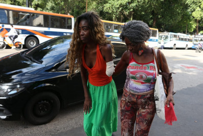 Amputações ocorridas na capital terão notificação obrigatória