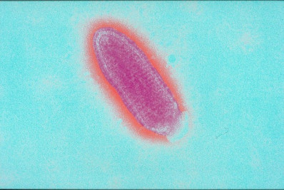 Surto de Marburg: OMS atualiza avaliação de risco da doença; entenda