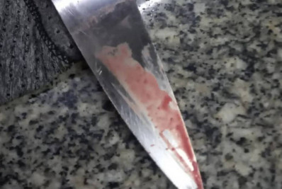 Vítima de tentativa de feminicídio no Piscinão de Ramos tem quadro estável