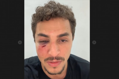 Secretário da Juventude é agredido e assaltado na Barra da Tijuca