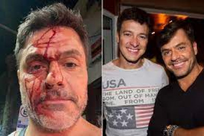 Irmão de Rodrigo Faro se envolve em acidente de carro: 'Uma fatalidade'