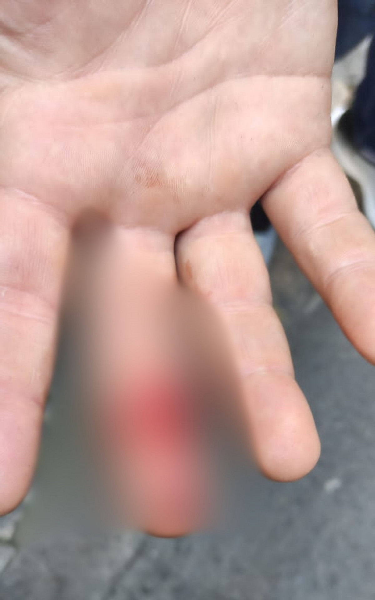 Agente da Seop foi ferido no dedo, sendo preciso levar ponto para fechar o corte