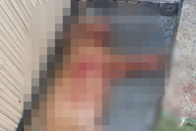 Compositor foi atacado por pitbull enquanto tentava fazer curativo no rabo do cão, diz polícia