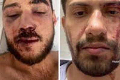 Casal brasileiro gay é espancado em Lisboa