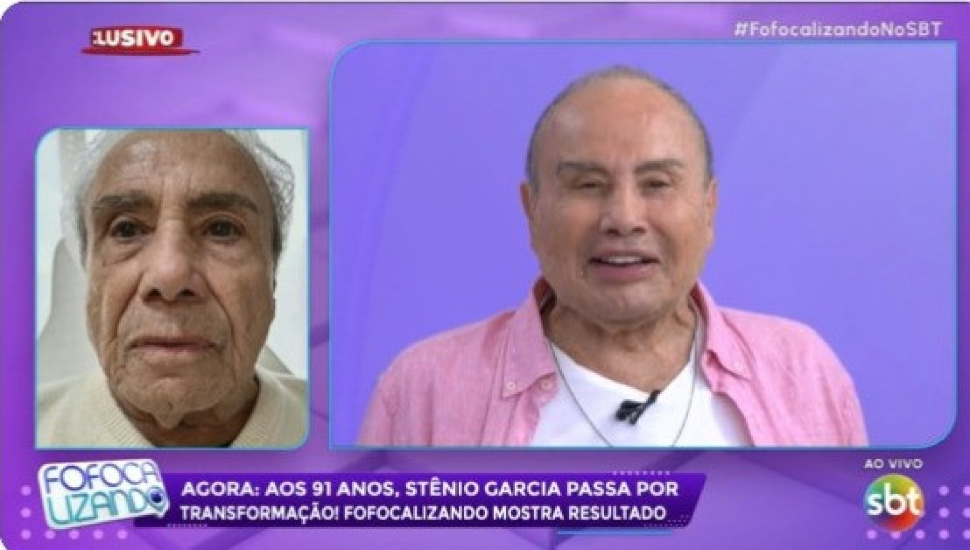 Stênio Garcia mostra resultado de harmonização facial ao vivo no SBT - Reprodução/SBT