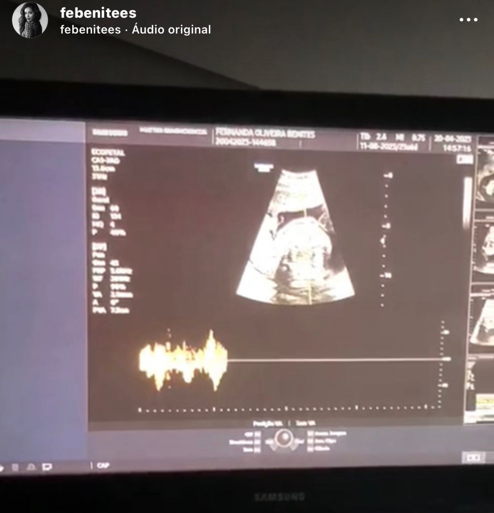Thiago Servo e Fernanda Benites - Foto reprodução Internet e Instagram