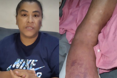 MC Katia revela tumor benigno e desabafa: 'Não estou conseguindo andar'