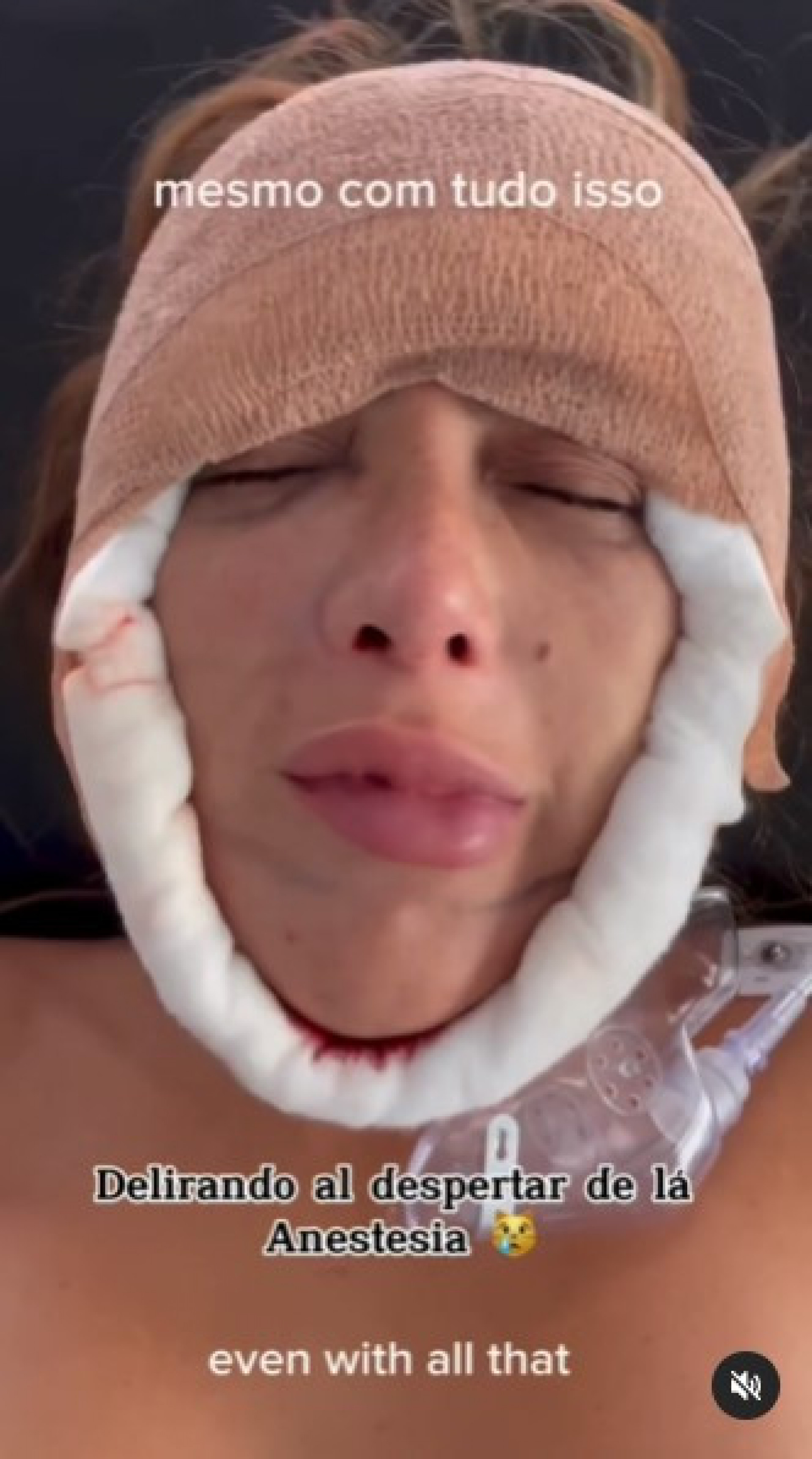 Atriz Desabafa Após Cirurgia De Emergência Por Problemas Com Silicone Industrial Celebridades