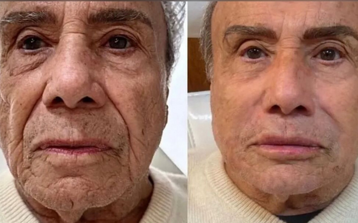 Aos 91 anos, Stenio Garcia busca rejuvenescimento com procedimento estético - Foto: Divulgação
