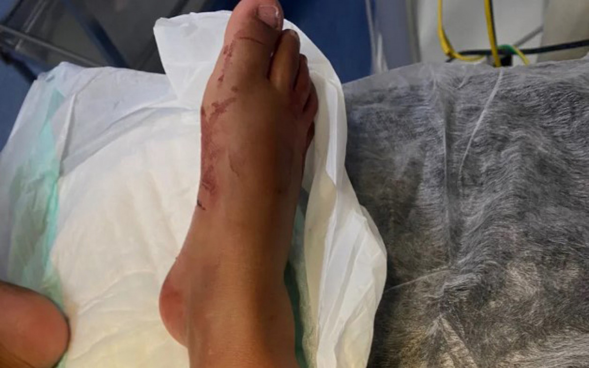 Menina de 2 anos leva pontos