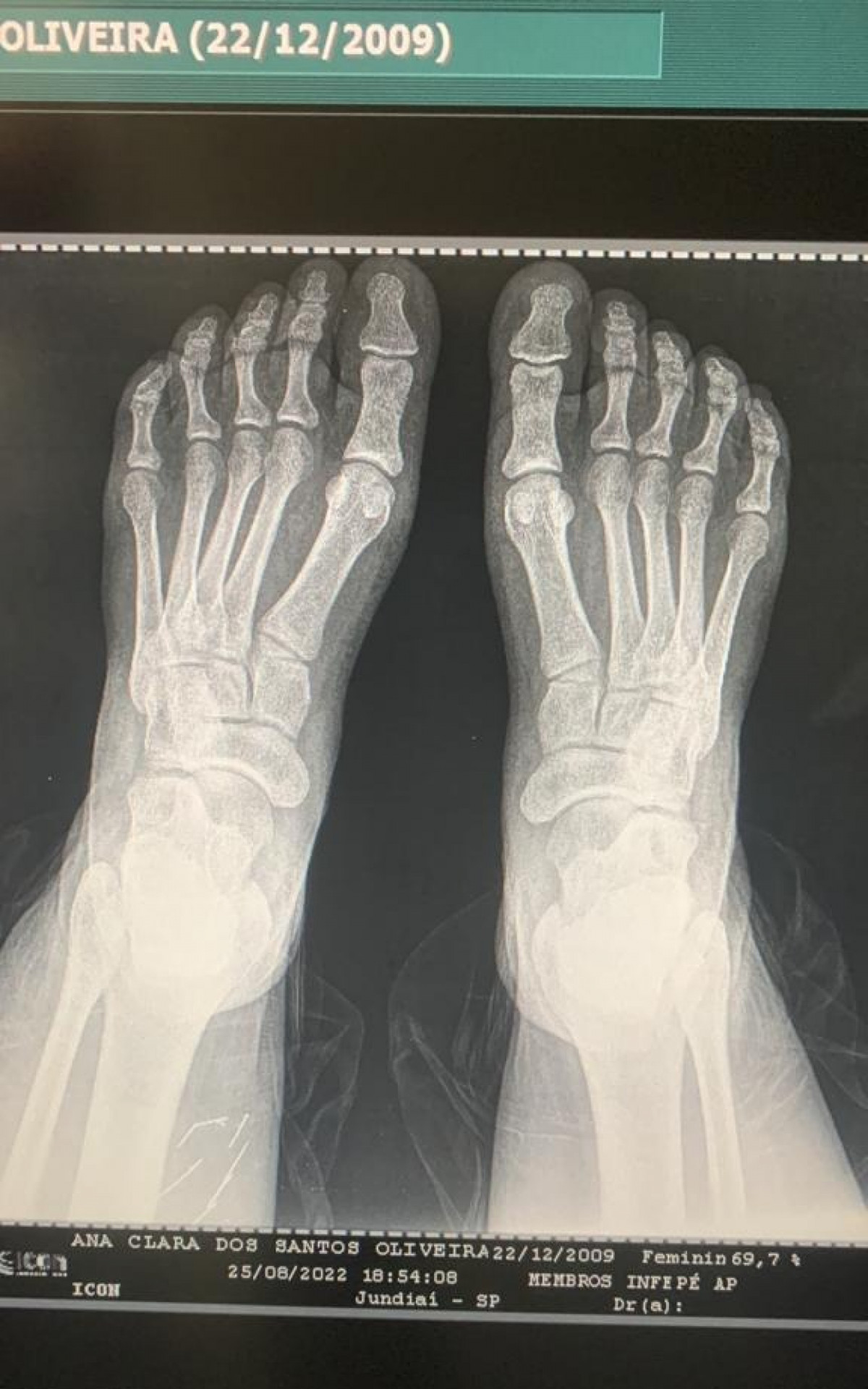 Exames comprovam que a estrutura óssea pertence a uma adulta - Divulgação