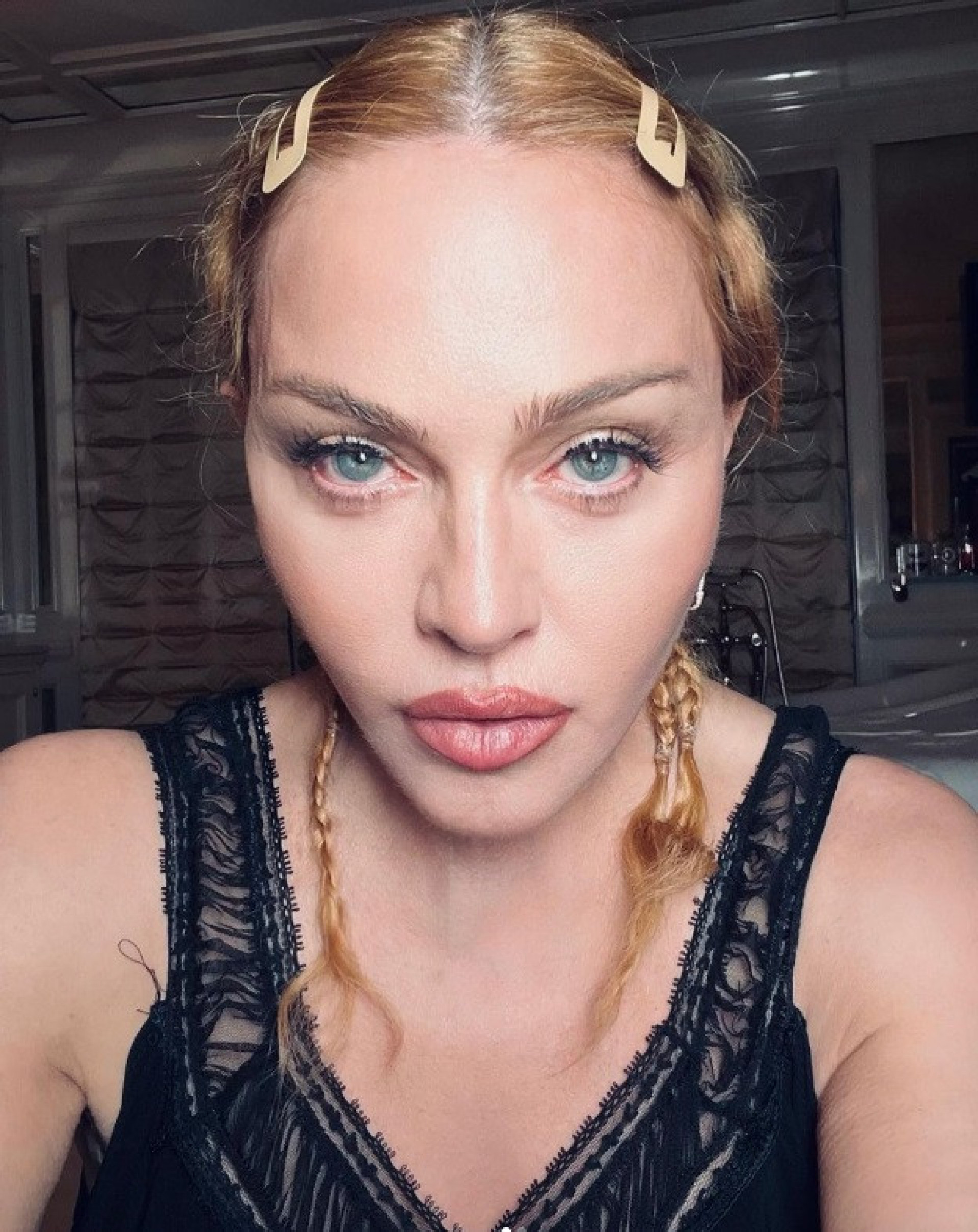 Madonna está na Unidade de Terapia Intensiva de um hospital dos Estados Unidos - Reprodução do Instagram