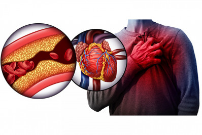 Novo remédio contra o colesterol, administrado duas vezes ao ano, é aprovado pela Anvisa
