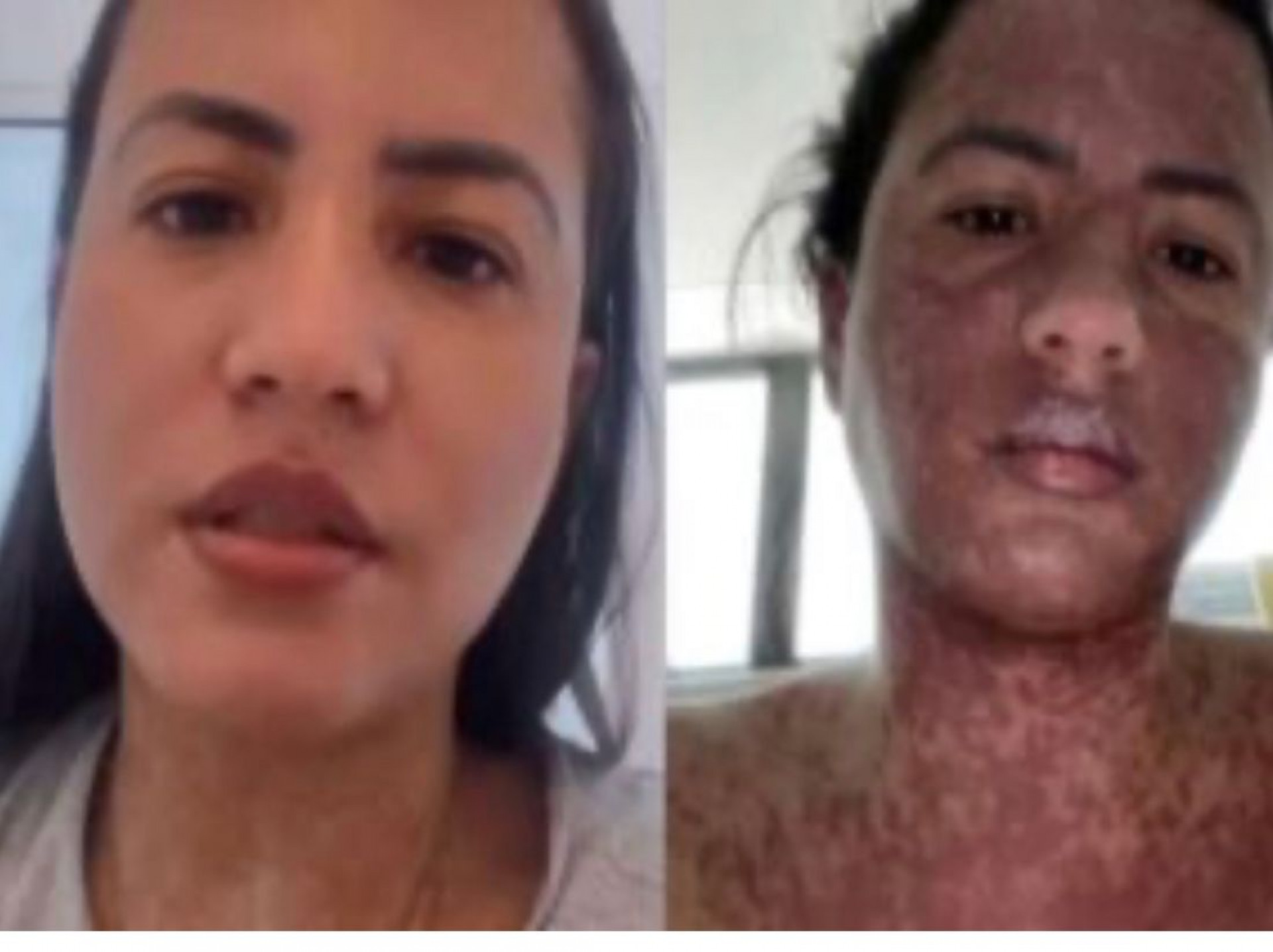 Caroline Aguiar - Foto reprodução Internet