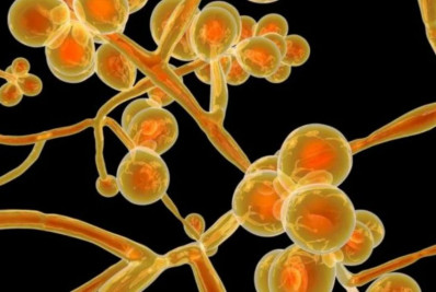 Pernambuco registra décimo caso de superfungo