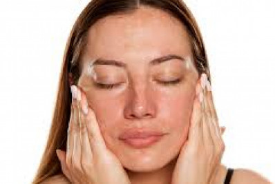 Melasma: por que é conhecido como a 