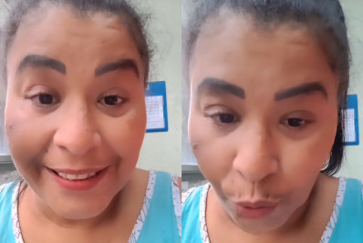 MC Kátia passa por cirurgia de retirada de mioma e revela que terá que amputar parte do pé