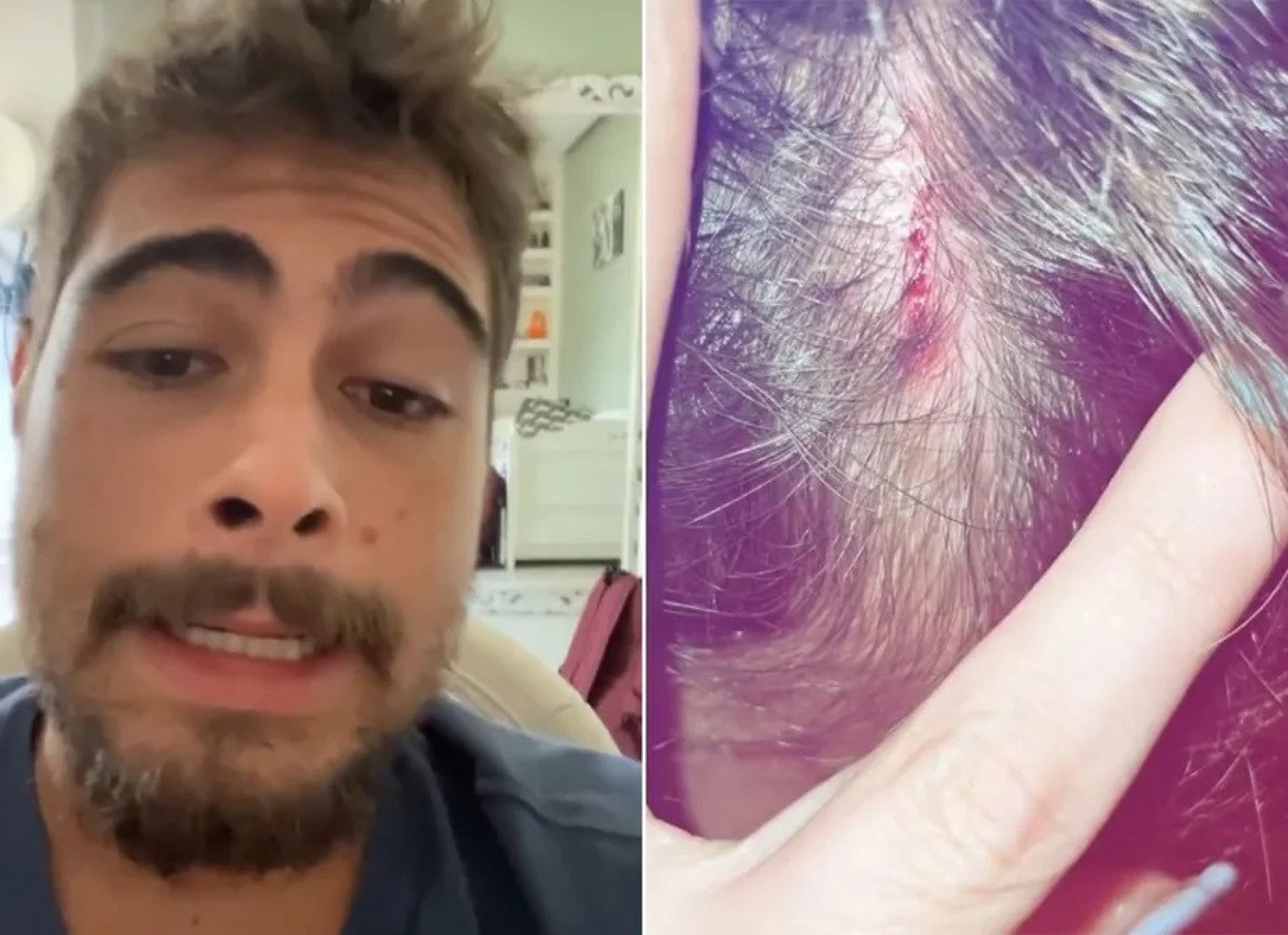 Rafael Vitti se machuca durante o surfe - Reprodução do Instagram