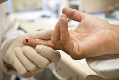 Pandemia de Aids pode acabar até 2030, diz Unaids