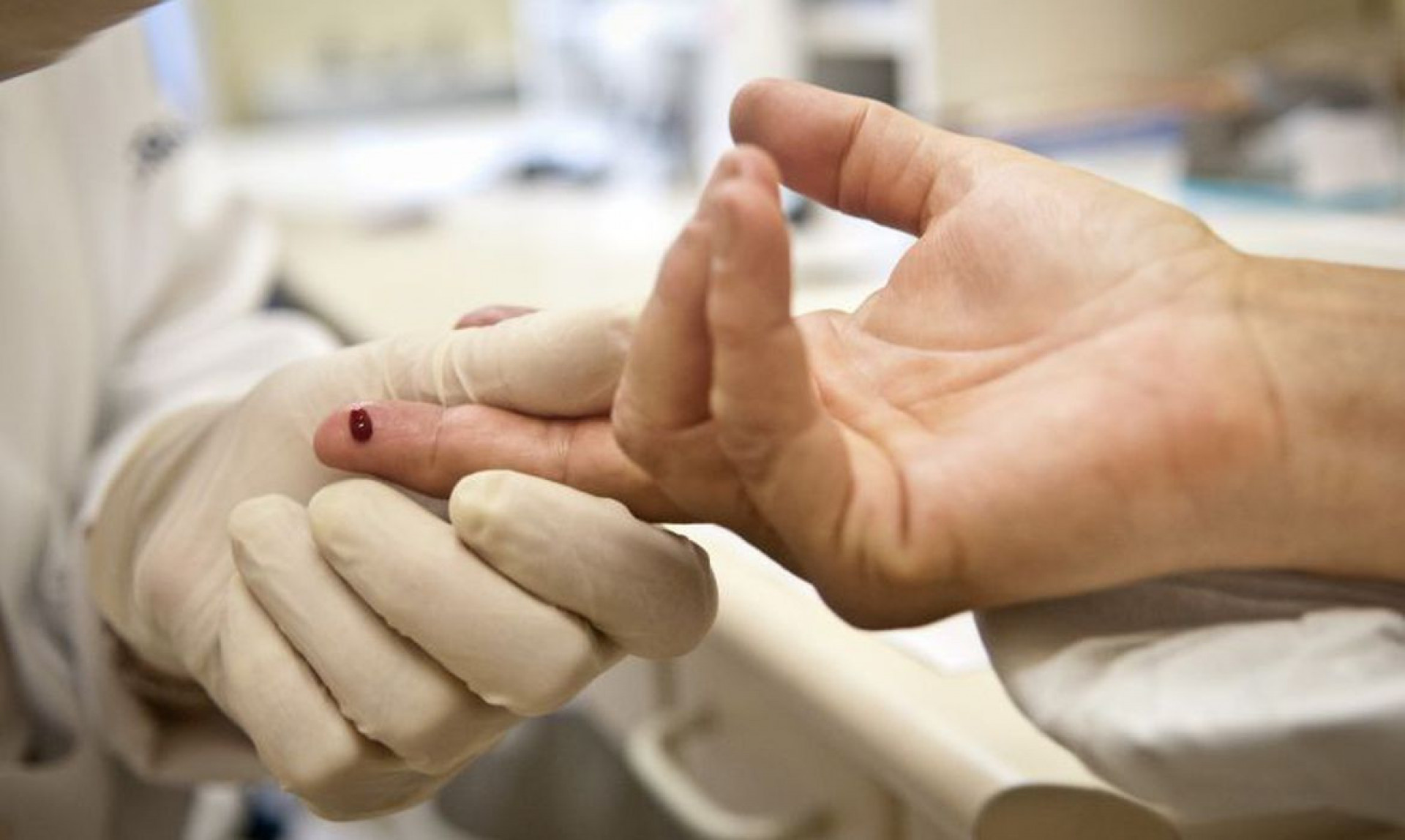 Brasil vai na contramão e casos de aids avançam 20% - QTU Questões do Universo