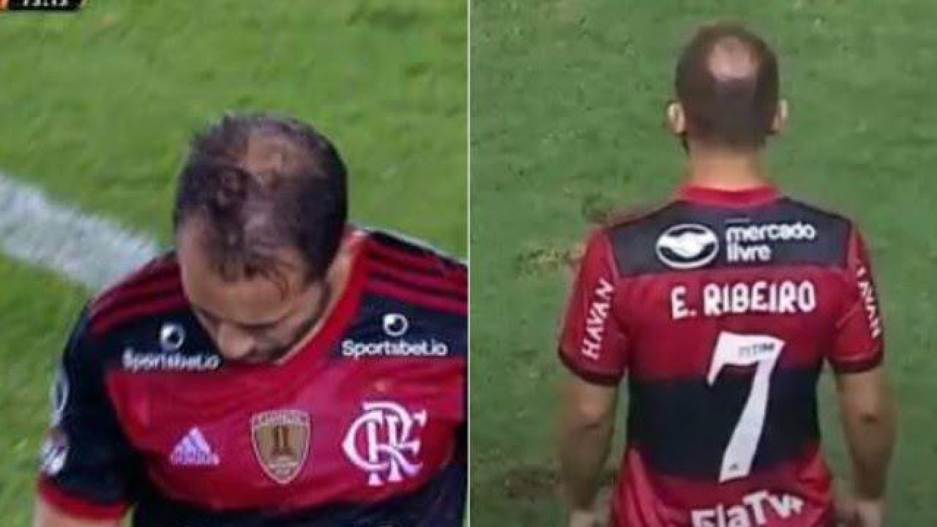 Everton Ribeiro revela em vídeo como se tornou 'ex-calvo