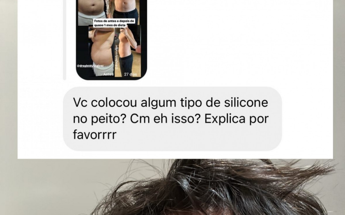 Eliezer revela diagn&oacute;stico de ginecomastia