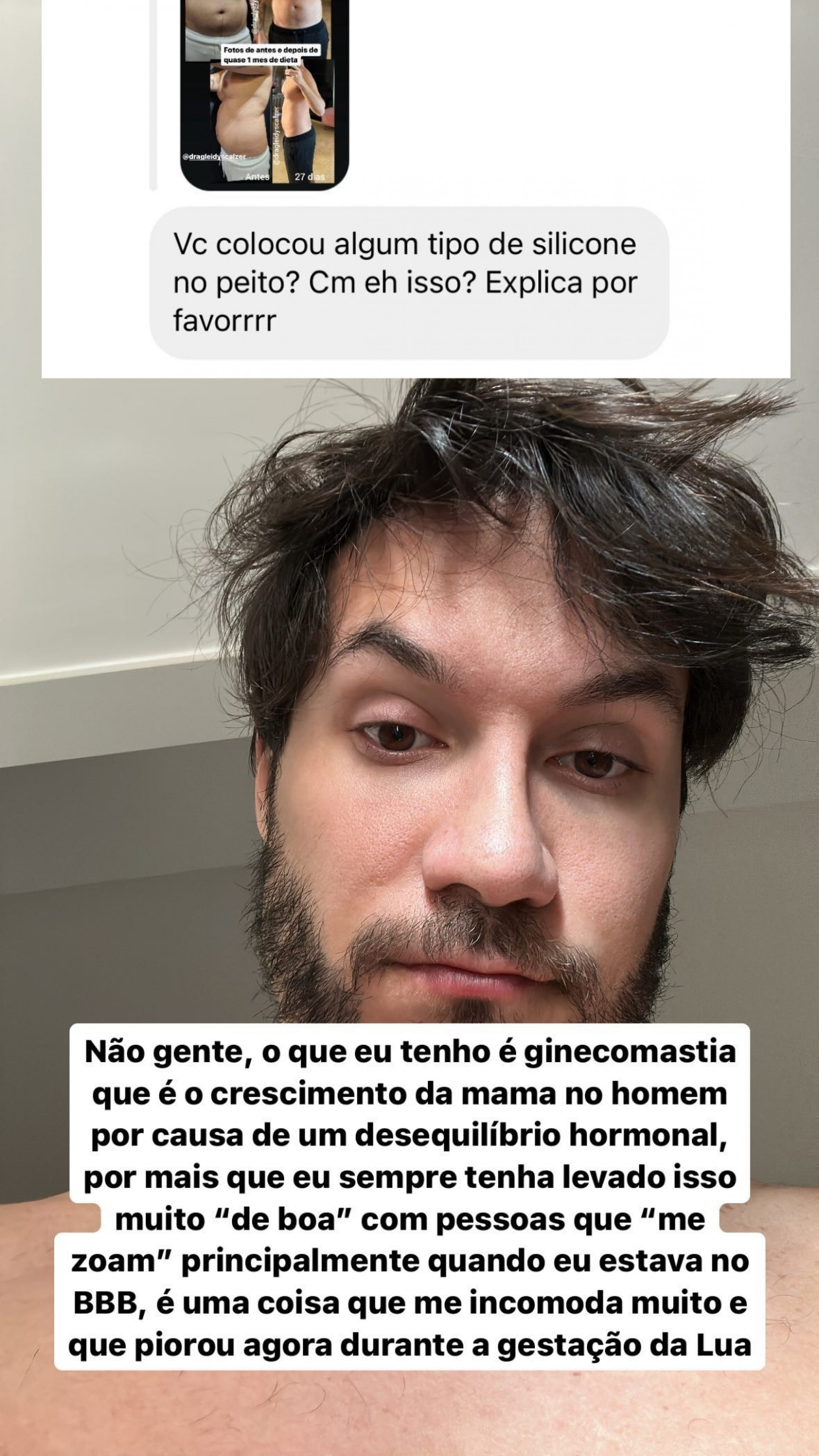 Eliezer revela diagnóstico de ginecomastia - Reprodução do Instragram